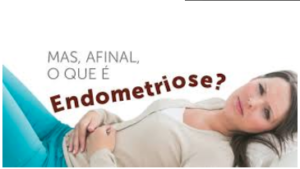 Endometriose 300x169 - Endometriose, mais o que é afinal esta terrível doença?