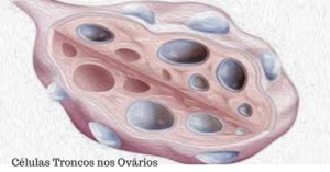 Celulas Troncos 300x157 - Adeus Menopausa Prematura, Revista Natura.