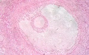 Foliculo 300x185 - Um Guia completo, Período fértil ciclo menstrual e a ovulação